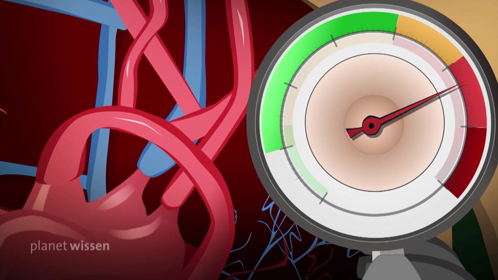 Grafik: Anzeige eines Blutdruckmessers mit der Nadel im roten Bereich.